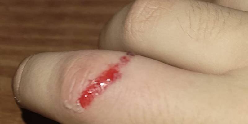 Take Care of Your Fingers: Crossbow Hunting Tips